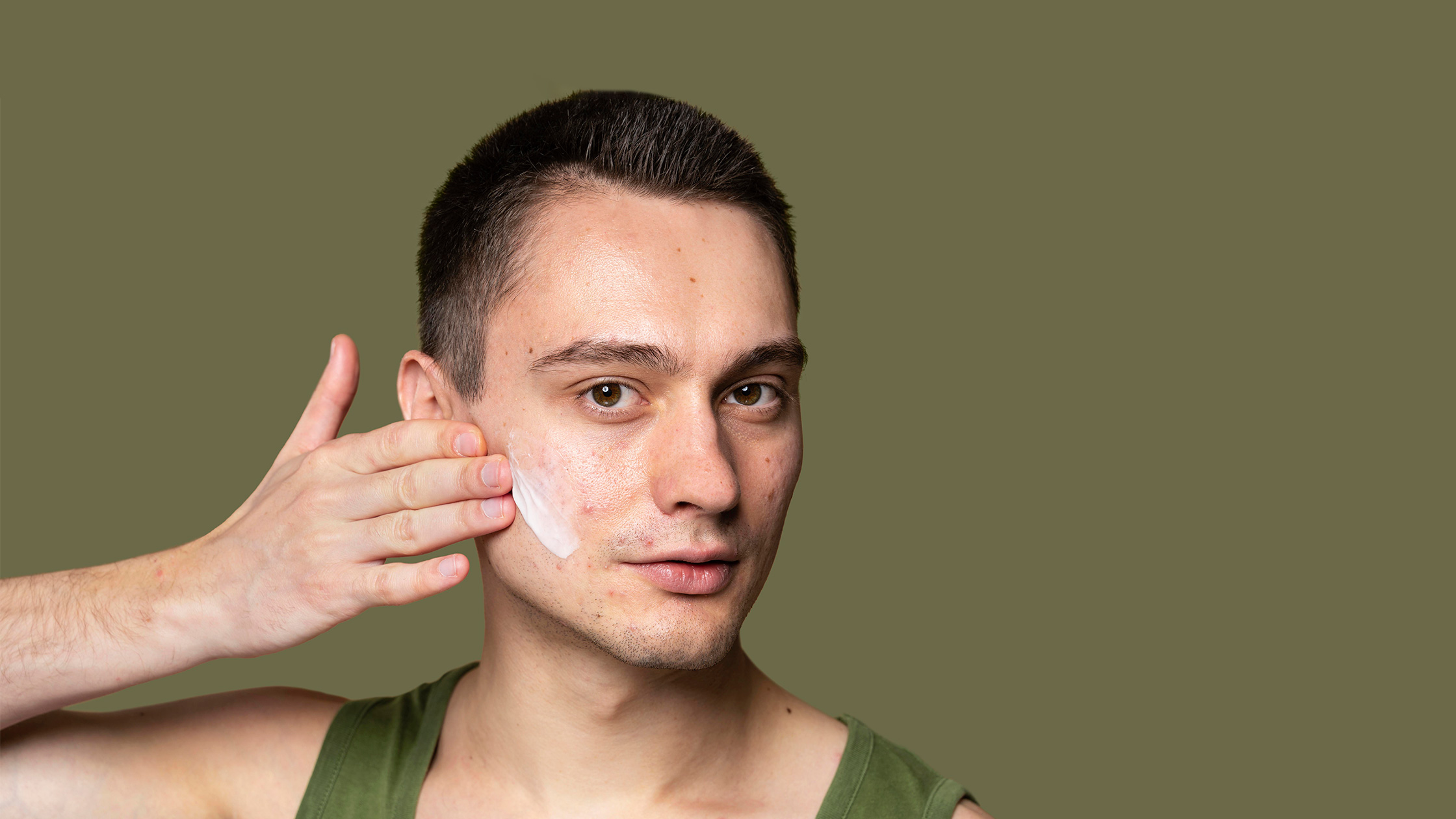 Descubre los secretos para combatir el acné y lucir una piel radiante